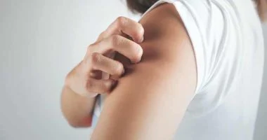 خمسة تعديلات غذائية للتحكم في أعراض الصدفية وتخفيف تهيج الجلد.