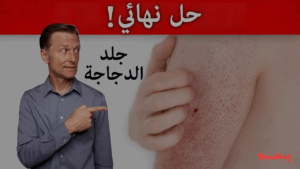 هتبقي بشرة بيبي.. أفضل وصفات طبيعية مجربة لعلاج جلد الوزة وتنعيم البشرة