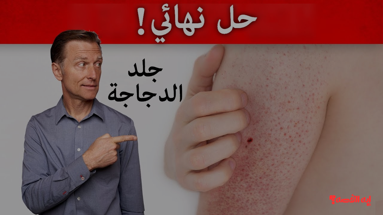 هتبقي بشرة بيبي.. أفضل وصفات طبيعية مجربة لعلاج جلد الوزة وتنعيم البشرة