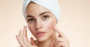 السيطرة على حب الشباب الموسمي.. 5 تعديلات بسيطة يوصي بها أطباء الجلدية