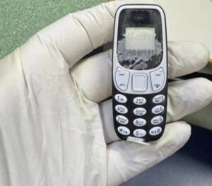 فريق طبي ينجح في استخراج هاتف محمول من بطن مريض ظل داخله 11 شهرا