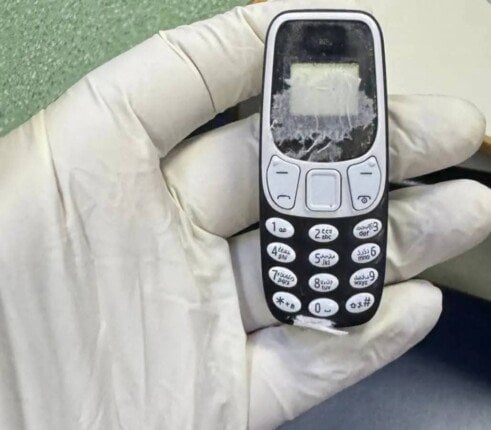 فريق طبي ينجح في استخراج هاتف محمول من بطن مريض ظل داخله 11 شهرا