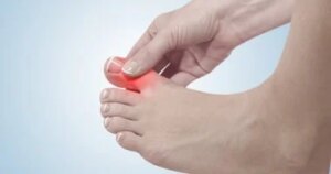 خمسة خضراوات لا غنى عنها في نظامك الغذائي لخفض حمض البوليك وتفادي نوبات النقرس المؤلمة.