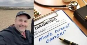 ظنه أمرًا عابرًا.. رجل أمريكي يروي كيف تحول الإهمال إلى صراع مع سرطان الثدي.