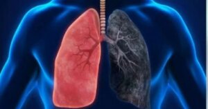 للحد من خطر سرطان الرئة.. 4 إجراءات وقائية يتجاهلها معظم الناس