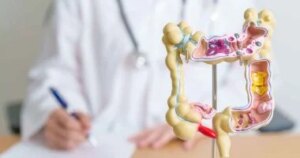 لم يعد مرضًا للمسنين.. سرطان القولون يهاجم الشباب بمعدلات مقلقة.