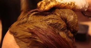 مركب طبيعي في الحناء يظهر نتائج واعدة في مكافحة تليف الكبد.