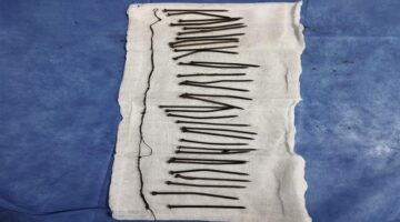 34 مسماراً الطب النفسي يوضح دوافع سيدة كفر الشيخ بعد