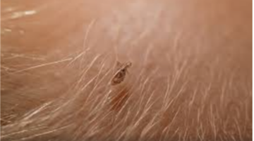 تحذير ابن سيرين ماذا تعني رؤية القمل في المنام حسب