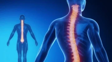 تحذير طبي لآلاف المراهقين كيف تحمي عمود طفلك الفقري من.webp