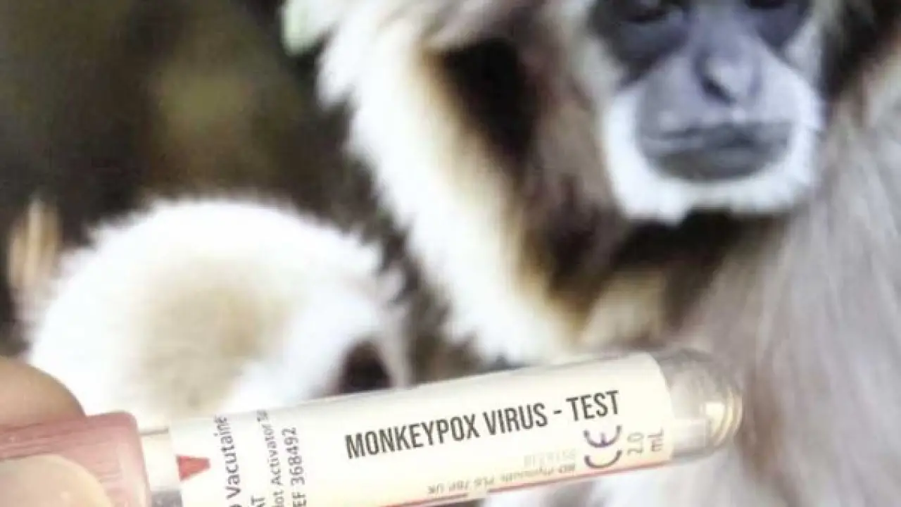 تحذير صحي عالي.. الكاميرون ترفع درجة التأهب بعد تفشٍ مقلق لجدري القرود