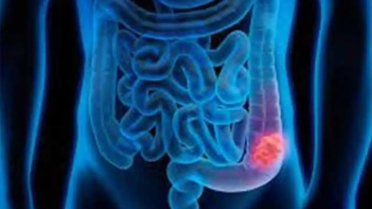 كنز في القمامة.. مادة مهملة تنهي معاناة آلام القولون وتقضي على الأمراض الشائعة