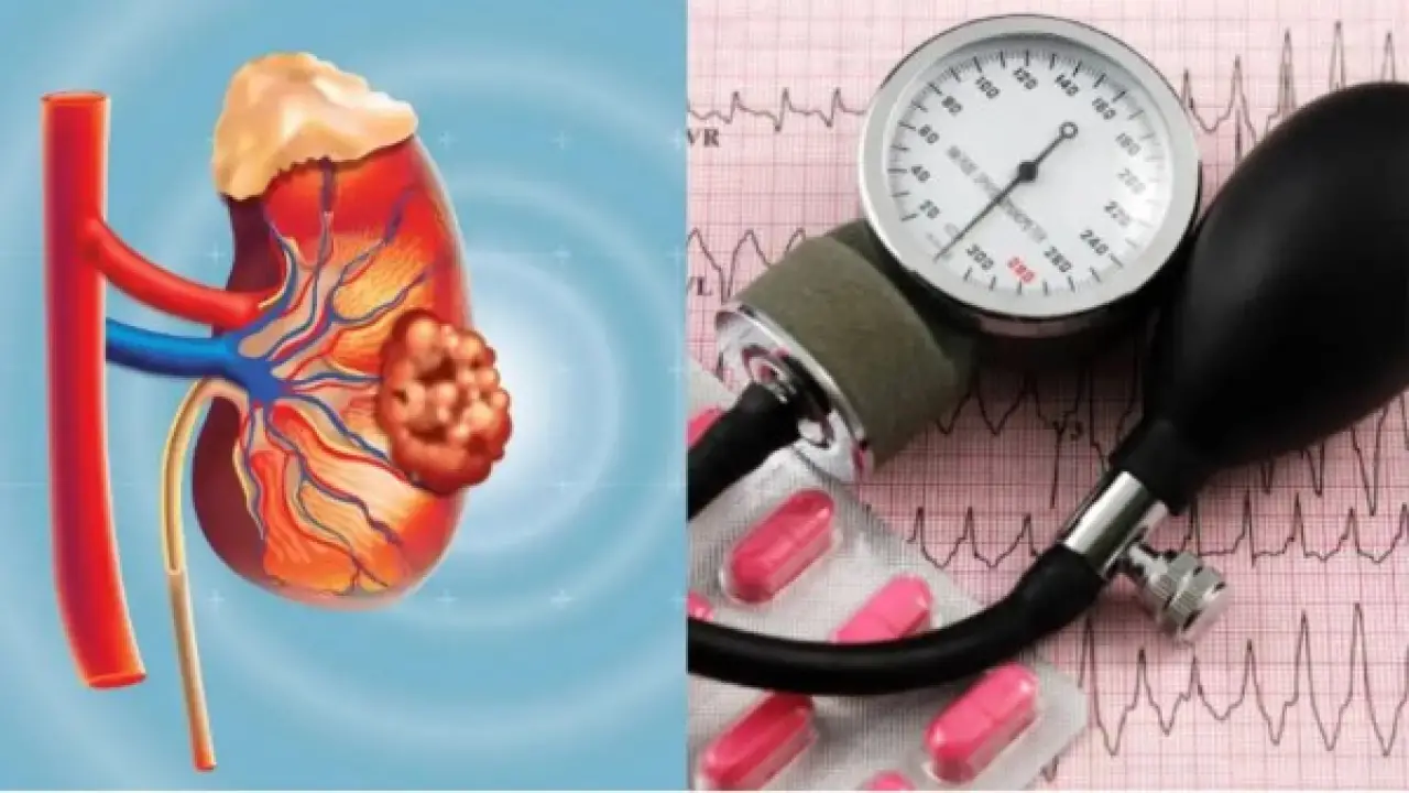 القاتل الصامت.. دراسة طبية تحذر من مضاعفات وخيمة تهدد حياة مرضى الضغط مرتفع أولي القوة.