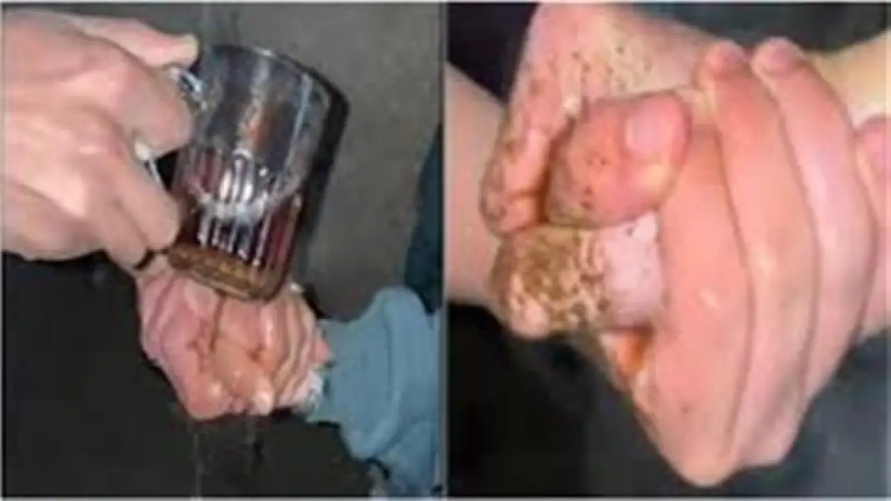 تحذير طبي قاتل.. تريند كوباية الشاي يهدد حياة الملايين في مطلع 2026