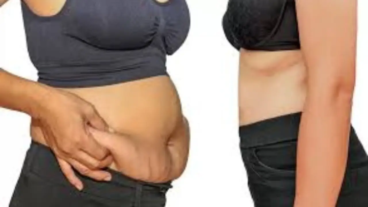 فخ السمنة الدائم.. دكتور أحمد صبري يحذر من خطأ يمنع خسارة الوزن تماماً