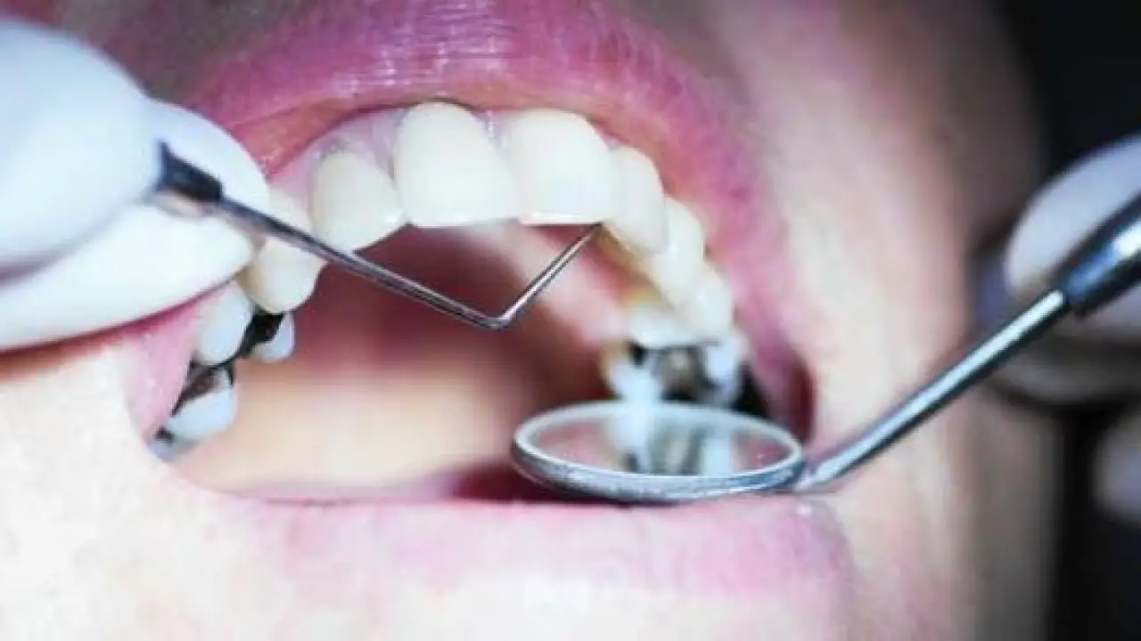 أطباء الأسنان.. مصير مجهول لثلاث دفعات بعد تحركات نقابية تحسم الجدل بقرار صادم