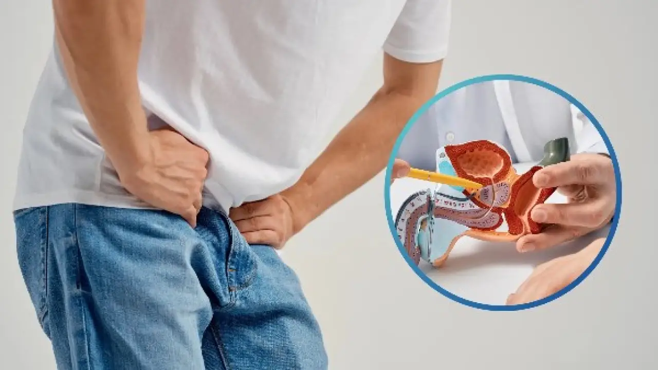 تضخم البروستاتا.. 5 عادات يومية تنهي المعاناة وتجنبك التدخل الجراحي المؤلم