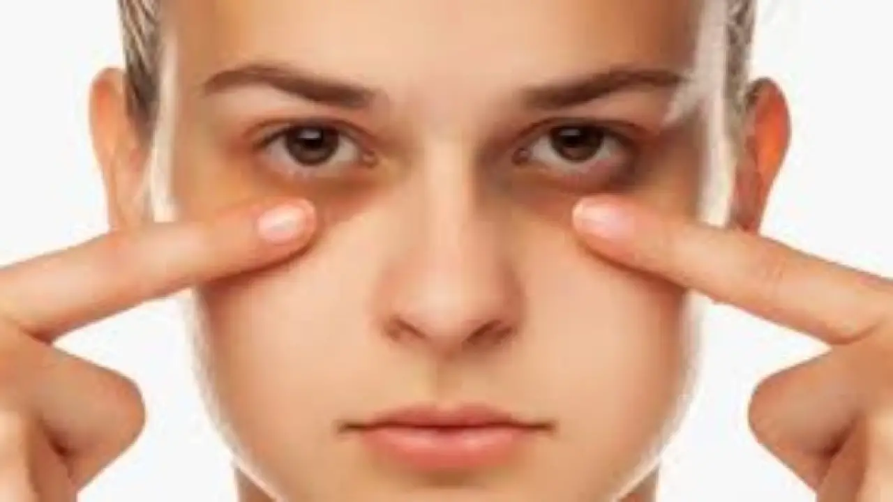 أسرار الهالات السوداء.. تحذير طبي من علامة خفية تظهر رغم النوم لساعات كافية