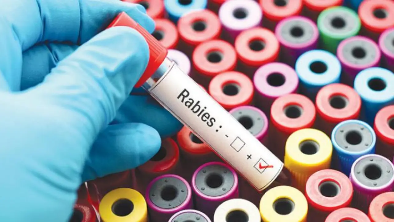 تحذير طبي مرعب.. مرض غامض تنقله الحيوانات الأليفة يهدد البشر بفاجعة مفاجئة