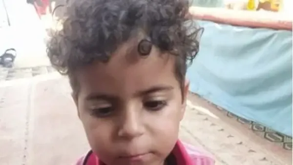 أحمد أبو عبيد في غزة يصارع الوقت بانتظار قرار طبي يوقف تدهور حالته الصحية