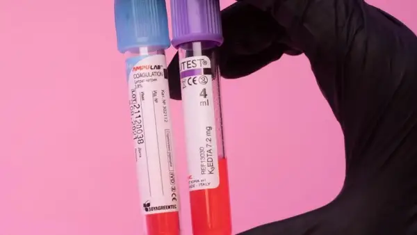 أسعار التحاليل الطبية في مصر 2025 تحدد تكلفة الكشف المبكر وأنواعها الأساسية