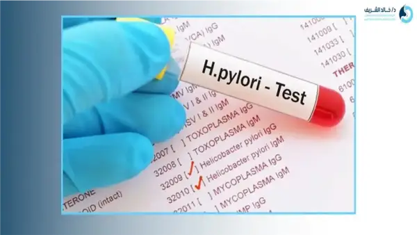 أسعار وأساليب تحليل جرثومة المعدة: كيف تختار الفحص المناسب وتحضر له؟