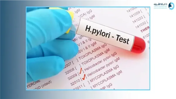 أسعار وأساليب تحليل جرثومة المعدة: كيف تختار الفحص المناسب وتحضر له؟