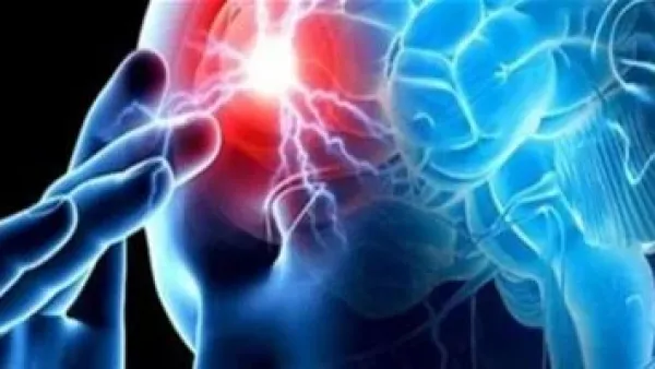 أطباء يحددون علامات مبكرة للسكتة الدماغية عند الرضع قد يتجاهلها الآباء.