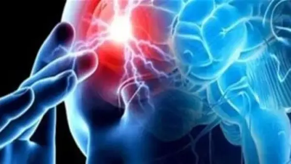 أطباء يحددون علامات مبكرة للسكتة الدماغية عند الرضع قد يتجاهلها الآباء.