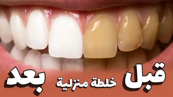 "اخفوها عنك الأطباء سنوات" وصفة منزلية فعالة لتبييض الأسنان وتخلصك من الاصفرار والجير بمكونات بسيطة