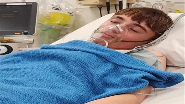 التدخين الإلكتروني يؤدي إلى انهيارات رئوية متكررة ويستدعي جراحة لإزالة قطعة سوداء من رئة مراهق نيوزيلندي