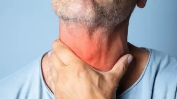 التهاب الحلق: لماذا يوصي الأطباء بالعسل والليمون قبل وصف المضادات الحيوية؟