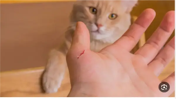 الوقاية من مرض السعار: مواعيد المصل المضاد والجرعات التنشيطية بعد التعرض للعض