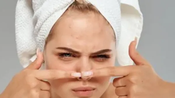 بثور الأنف المستعصية: أخطاء شائعة تفاقمها وعلاجات منزلية فعالة تنهي المشكلة.