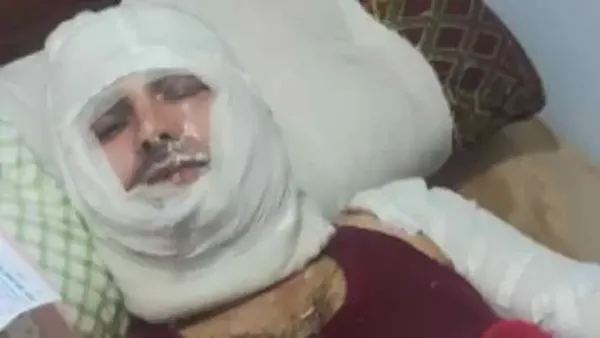 زوجة ضحية الدفاع عن منزله في كفر الشيخ تؤكد تعرضه لحرق عمد باستخدام البنزين