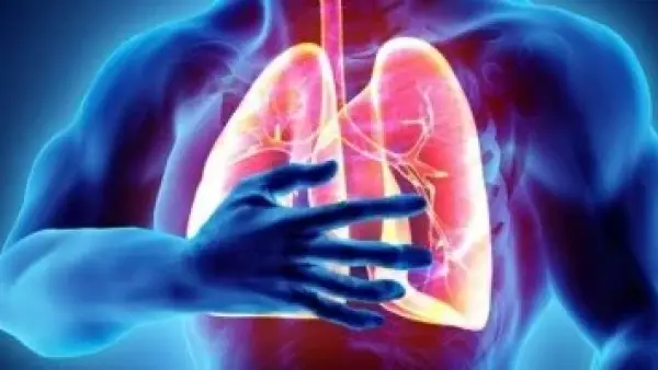 سعال لا يتوقف.. متى يتحول إلى مؤشر خطر لبداية الالتهاب الرئوي؟