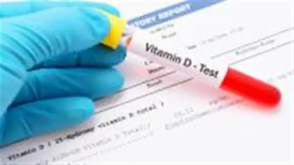 سعر تحليل فيتامين د في المعامل الطبية وتأثيره على إجراءات الكشف المبكر عن النقص