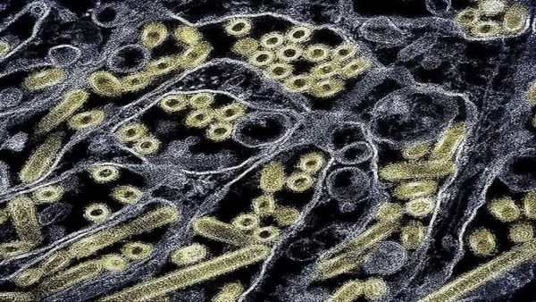 شهادة شفاء جديدة تُثري أبحاث فيروس نقص المناعة البشرية بعد زراعة خلايا جذعية ناجحة