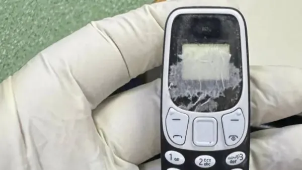 استخراج هاتف محمول من بطن مريض بعد 11 شهرا بمركز الجهاز الهضمي بالمنصورة