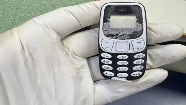 عاش بهاتفه المحمول في معدته 11 شهرًا.. قصة مريض المنصورة الذي حير الأطباء.