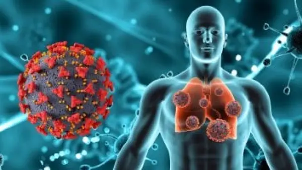 قبل السعال وألم الصدر.. علامات صامتة في أصابعك قد تكشف عن سرطان الرئة