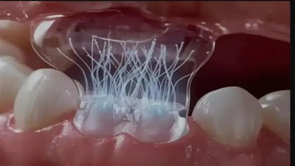 لاصقة بيولوجية تعيد نمو الأسنان بنسبة 100% عبر تحفيز الخلايا الجذعية في الفك
