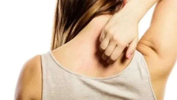 لقاح الحزام الناري يقلص خطر الإصابة بالخرف إلى النصف