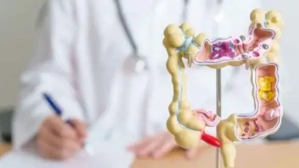 لم يعد مرضًا للمسنين.. سرطان القولون يهاجم الشباب بمعدلات مقلقة.