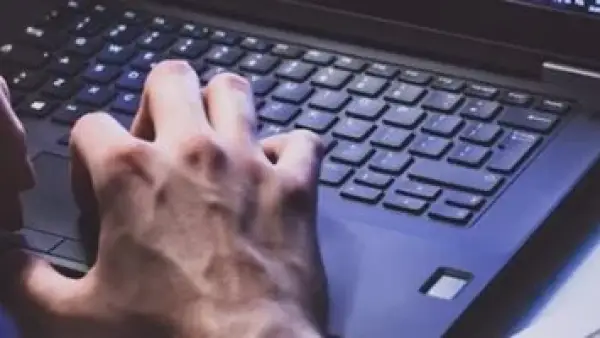 متى يتحول الشغف بالوظيفة إلى "إدمان عمل" يستهلك صحتك الجسدية والنفسية؟