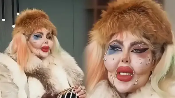 هارلي كوين الإيرانية تثير الجدل بإجرائها 388 عملية تجميل بـ50 مليون دولار واختيار أسلوب حياة بلا طعام سوى القهوة