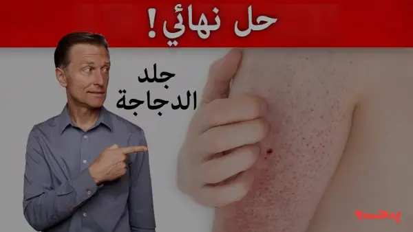 هتبقي بشرة بيبي.. أفضل وصفات طبيعية مجربة لعلاج جلد الوزة وتنعيم البشرة