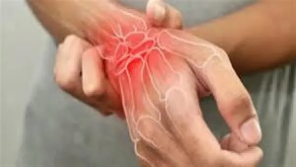 التهاب المفاصل الجوال: كيف يهاجم الجهاز المناعي مفاصل جديدة يوميًا بحثًا عن سبب أساسي