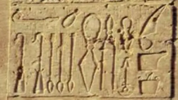 جراحة المخ وبتر الأطراف: أدوات تكشف براعة الطب في مصر القديمة