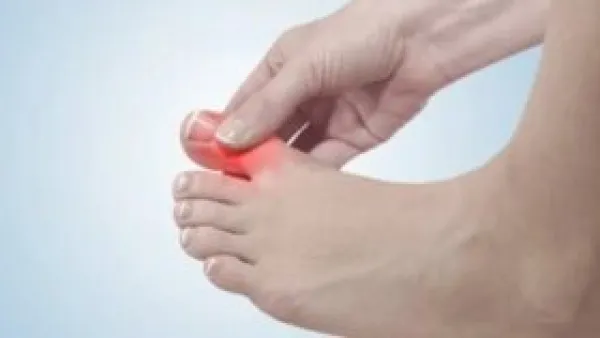 خمسة خضراوات لا غنى عنها في نظامك الغذائي لخفض حمض البوليك وتفادي نوبات النقرس المؤلمة.